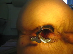 Anal Speculum 1